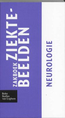 Zakboek ziektebeelden - Paperback (9789031364633)