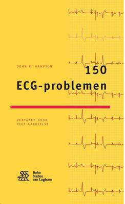 150 ECG-problemen - John R. Hampton - Paperback (9789036813730) 150 ECG-problemen - John R. Hampton - Paperback (9789036813730)