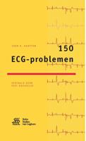 150 ECG-problemen - John R. Hampton - Paperback (9789036813730)