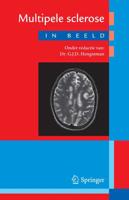 Multipele sclerose in beeld - Paperback (9789031399147)