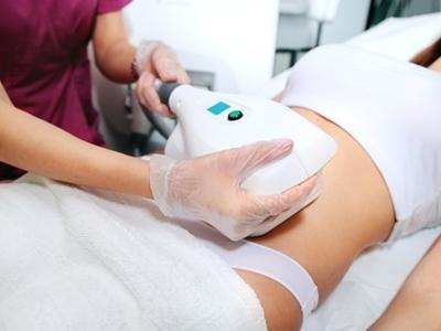 Vet bevriezen met cryolipolyse bij Yagmur Avci Hair & Beauty