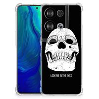 Extreme Case OPPO Reno8 Skull Eyes