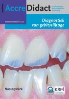 Diagnostiek van gebitsslijtage - Frank Lobbezoo, Peter Wetselaar - Paperback (9789089763785)