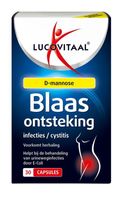 Blaasontsteking