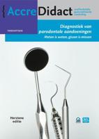 Diagnostiek van parodontale aandoeningen - Fridus van der Weijden - Paperback (9789089763594)