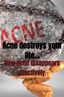 Acne destroys your life... - Jaquelien Papenhuijzen - ebook - thumbnail