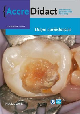 Diepe carieslaesies - A.J.P. van Strijp, E. Tijskens, R. Gruythuysen - Paperback (9789089761460)