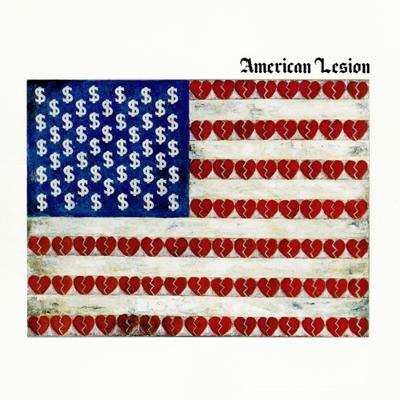 American Lesion - LP (8714092776515)