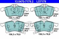 Remmenset, remschijf ATE, Remschijftype: Geventileerd: , Inbouwplaats: Vooras, u.a. für Opel, Vauxhall - thumbnail