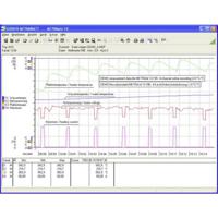 Gossen Metrawatt METRAwin 10 Meetsoftware Geschikt voor merk Gossen Metrawatt GMC-I METRAHIT Series - thumbnail