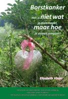 Borstkanker - Elizabeth Visser - Paperback (9789492247124)