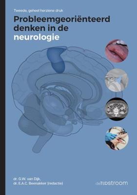Probleemgeoriënteerd denken in de neurologie - Paperback (9789058983367) Probleemgeoriënteerd denken in de neurologie - Paperback (9789058983367)